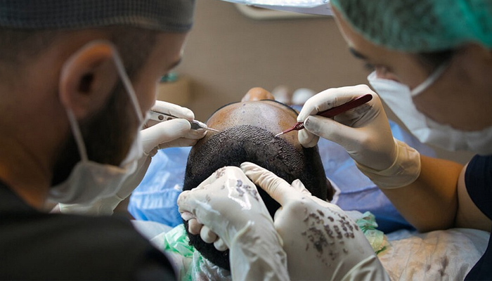 Regrow Your Hair With The Best Clinic For Hair Transplant